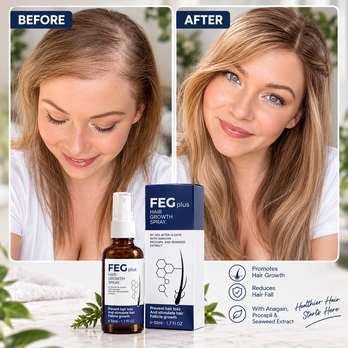 FEG Plus Hair Growth Spray – Hair Growth & Scalp Care Treatment