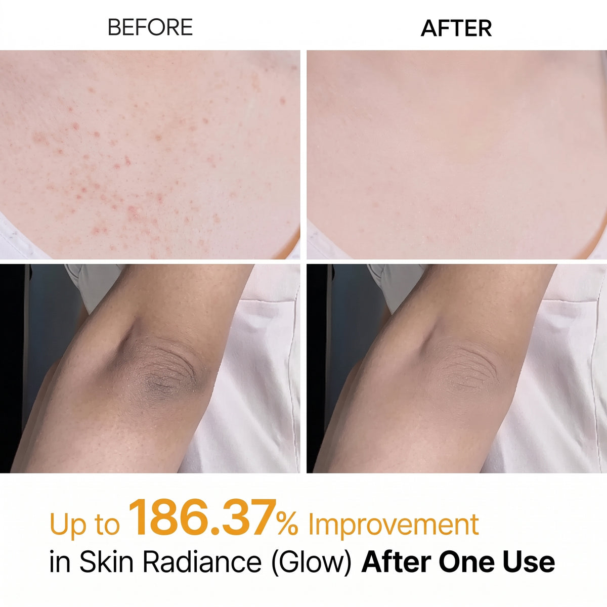Dr.Melaxin Peel Shot Kojic Acid Spray for Skin Brightening & Skin Care