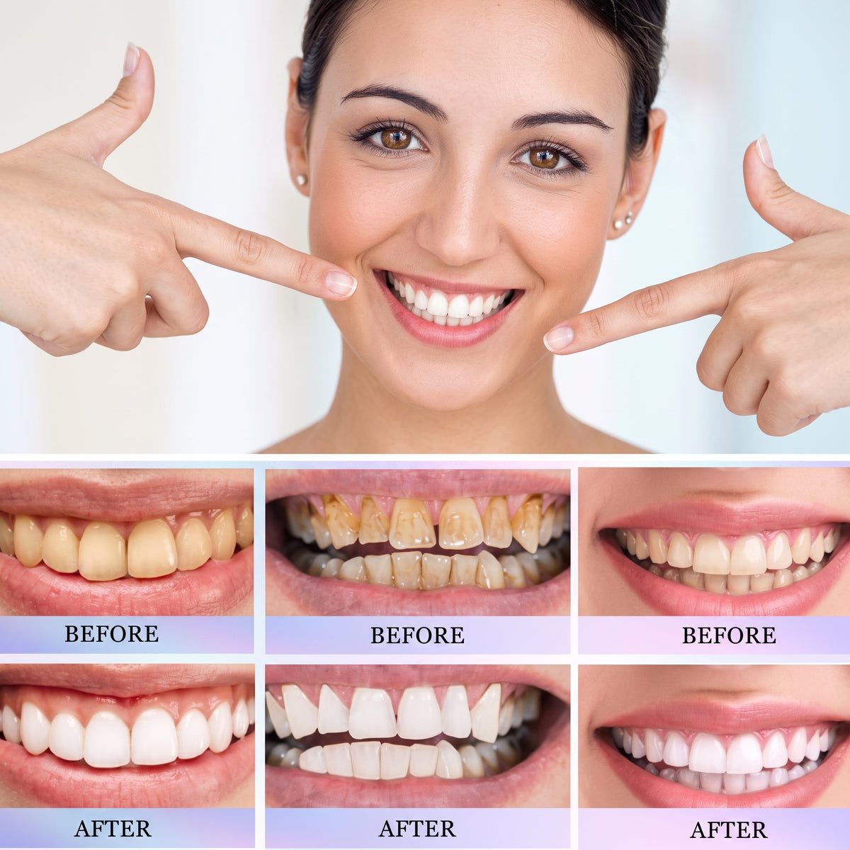 Oralhoe Nicotinamide Whitening Toothpaste – Dazzle White Toothpaste for Brighter Teeth